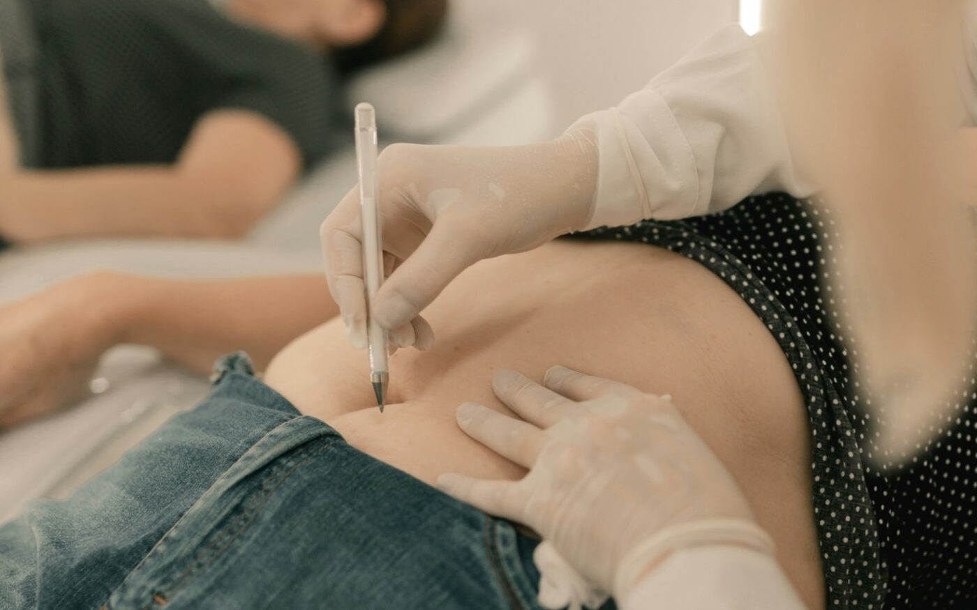 Zorgverlener met handschoenen tekent met een markeerstift een punt af op de onderbuik van een vrouw